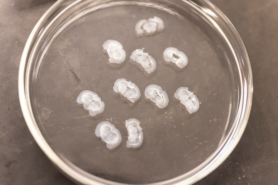 Thin white slices of an adolescent rat brain sit in a dish to be used in a study on the effect of THC, the psychoactive ingredient in marijuana.